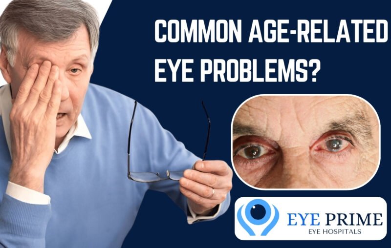 What are the Common Age-Related Eye Problems?