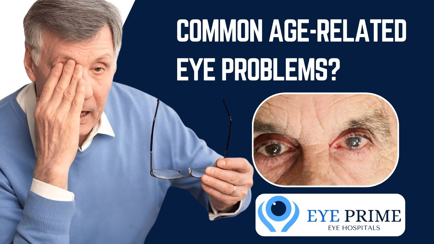 What are the Common Age-Related Eye Problems?