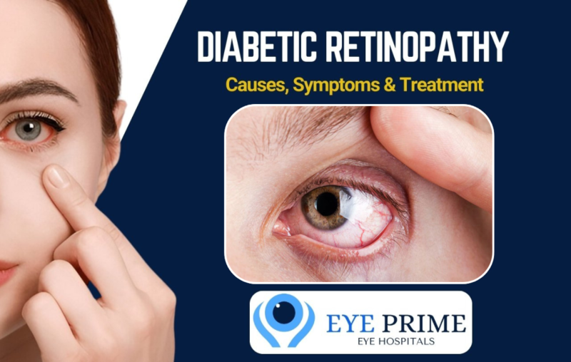 Eye Hospital in Hyderabad